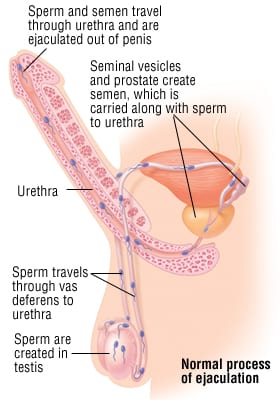 Men ejaculating too quickly may be caused by these factors