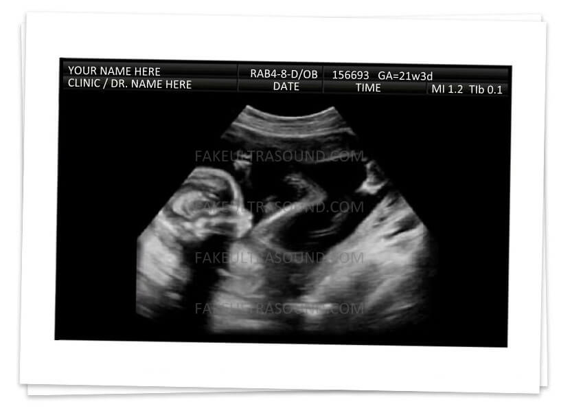 How to Use Fake Ultrasound Prank Ideas Safely and Wisely