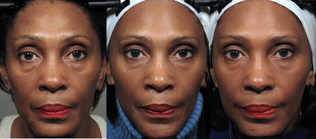 Happy facial exercises： Do they really work？ Find out now!