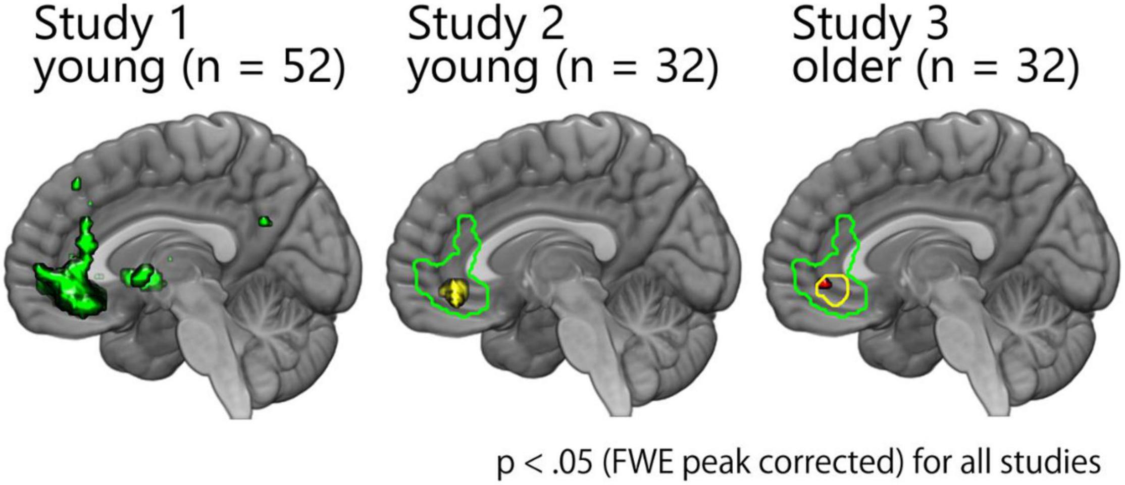 What are the characteristics of ventromedial prefrontal cortex in different ages?